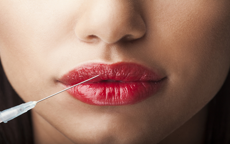 Botox Lips NikiLitoviStock  Getty Images Plus