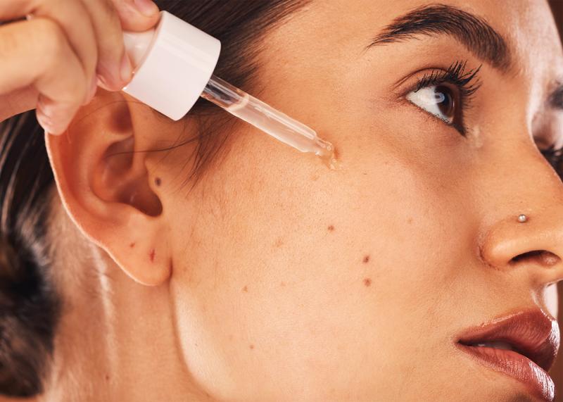 Acne treatment
