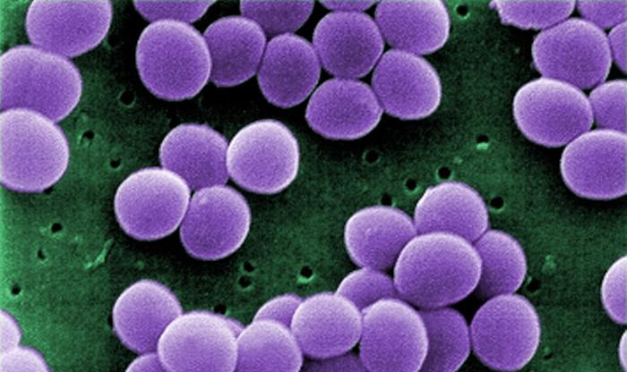 S aureus infection