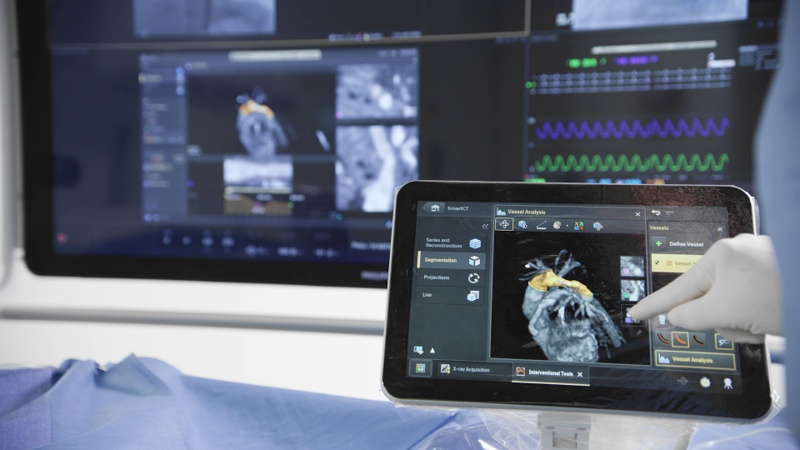 Philips Azurion