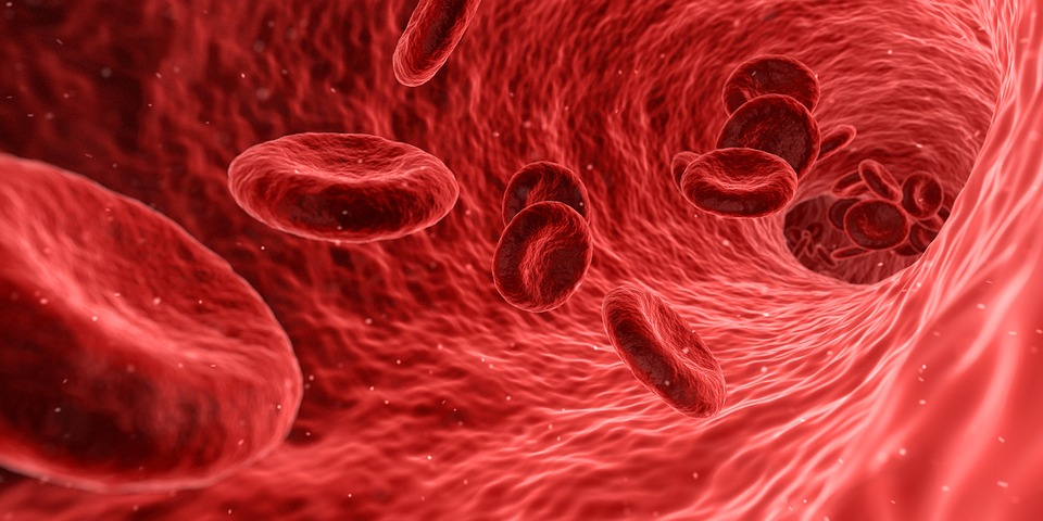 Minimally invasive blood flow probe allows continuous monitoring Pixabay