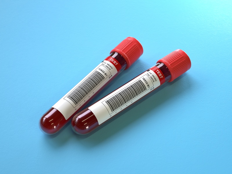 blood test tube