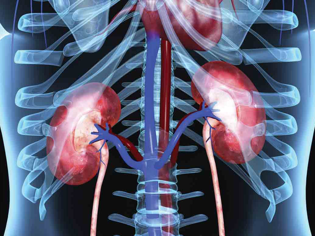 Patients undergoing kidney dialysis must have their hydration level closely monitored a newly-developed portable sensor make