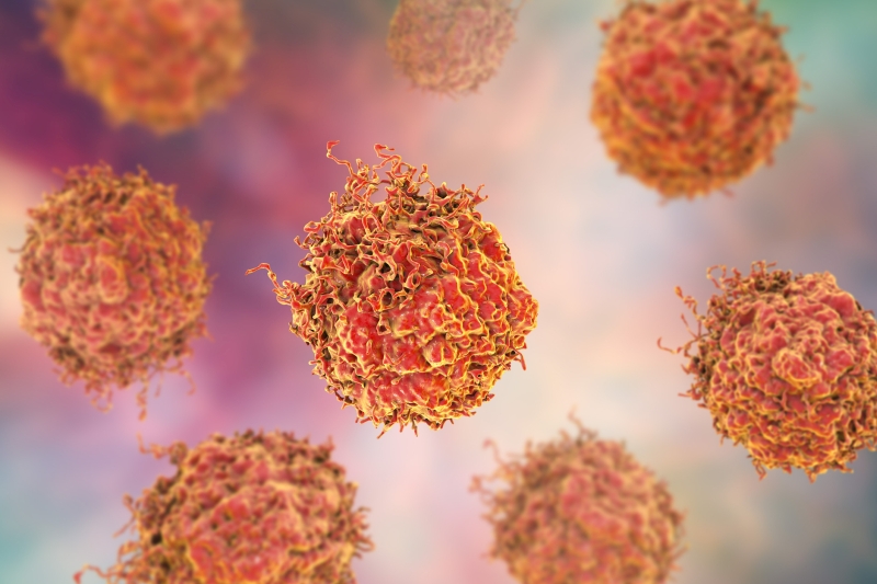 Prostate Cancer