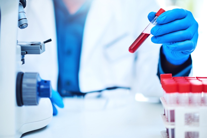 blood test tube