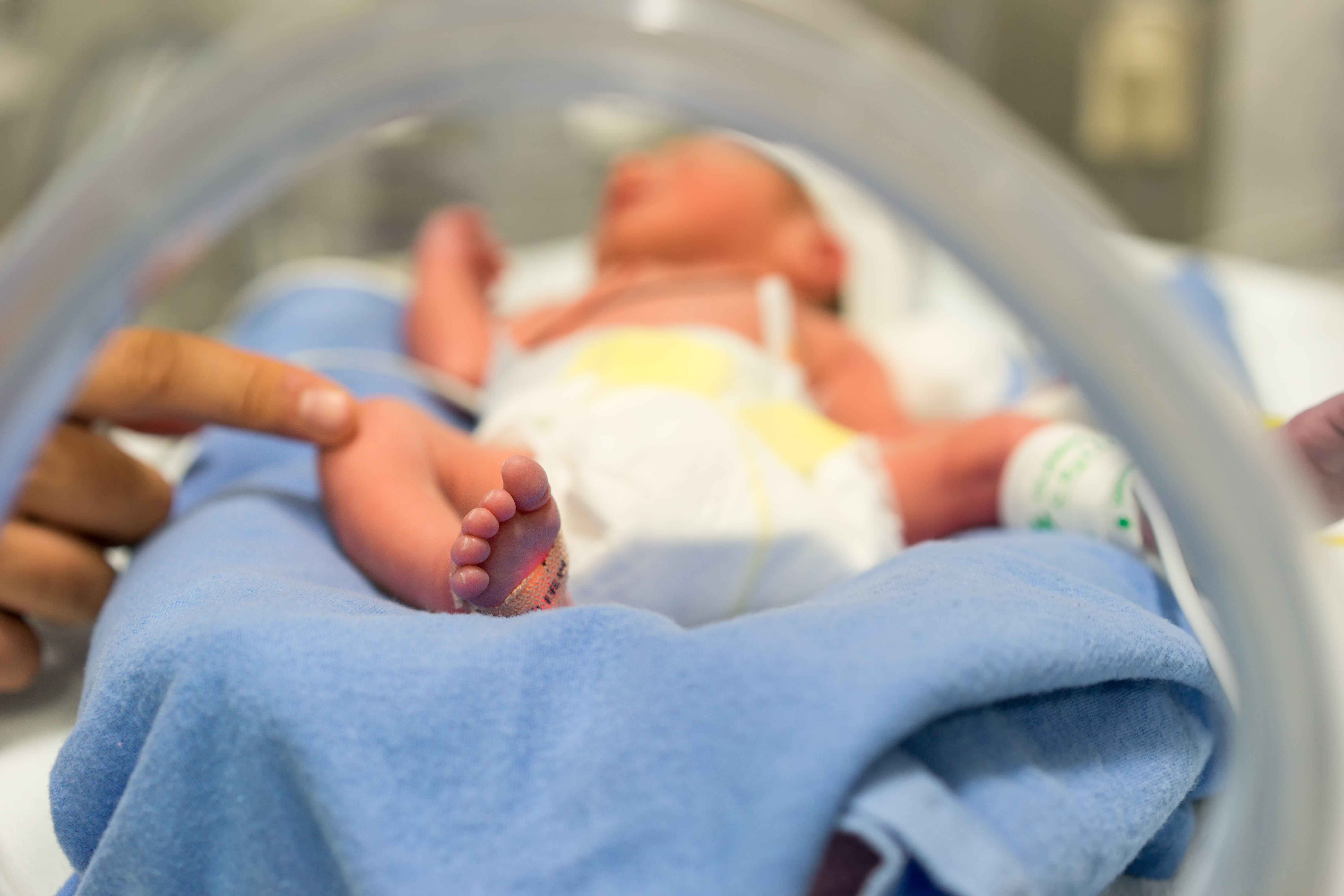 NICU