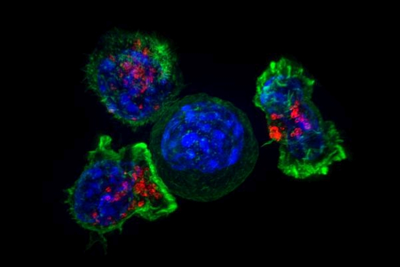cancer cell surrounded by killer T cells