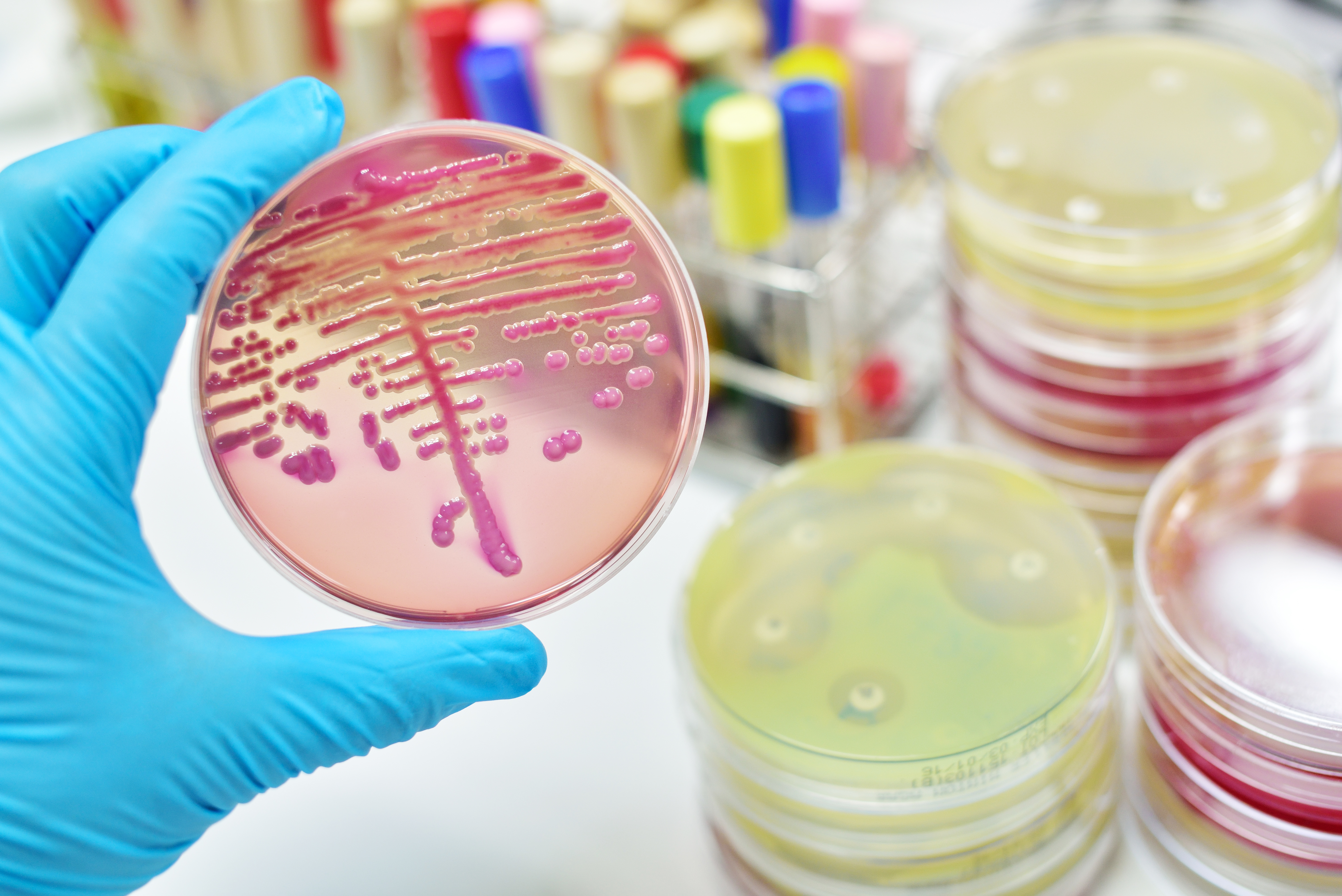 gloved hand holding up bacteria culture