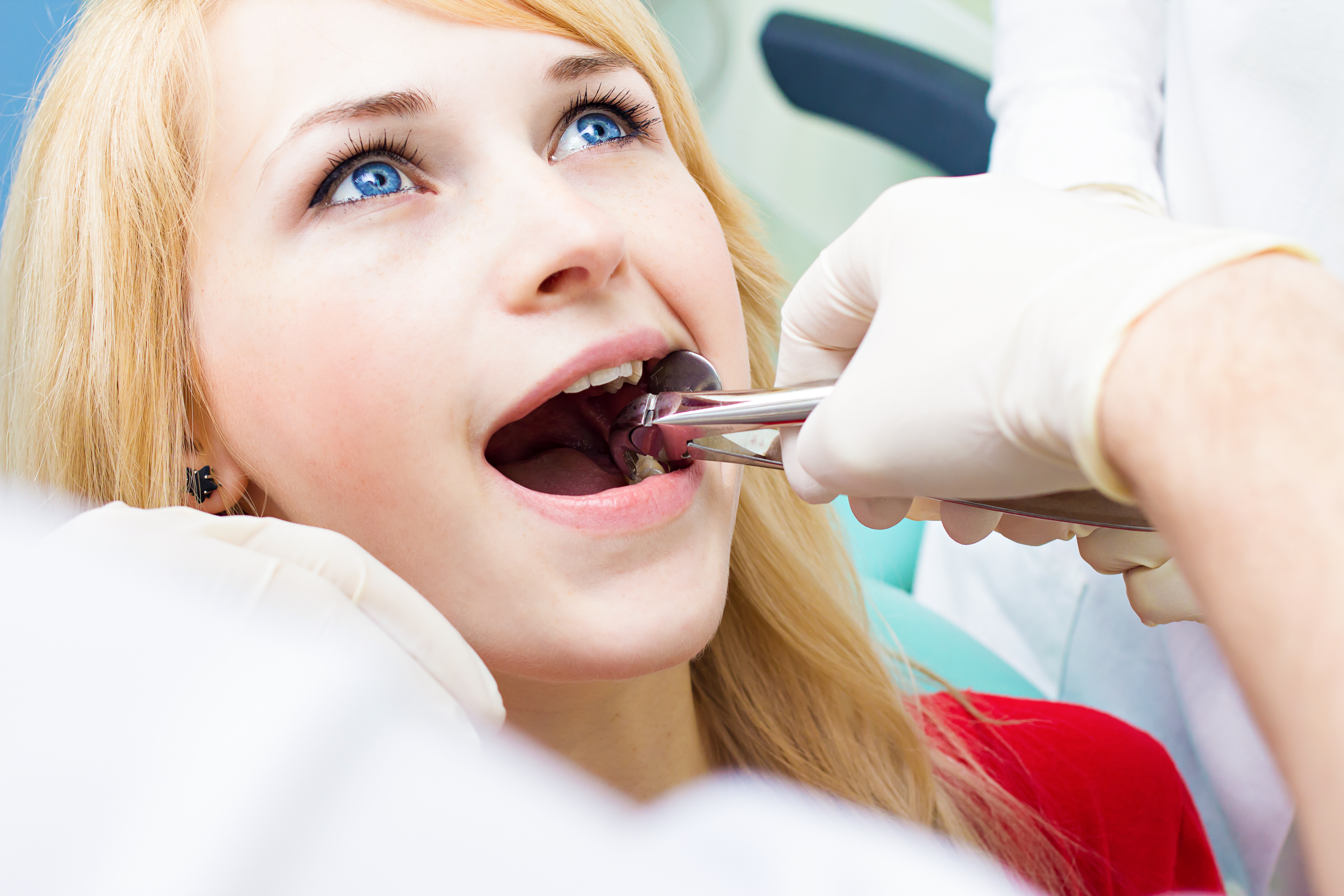 Wisdom tooth