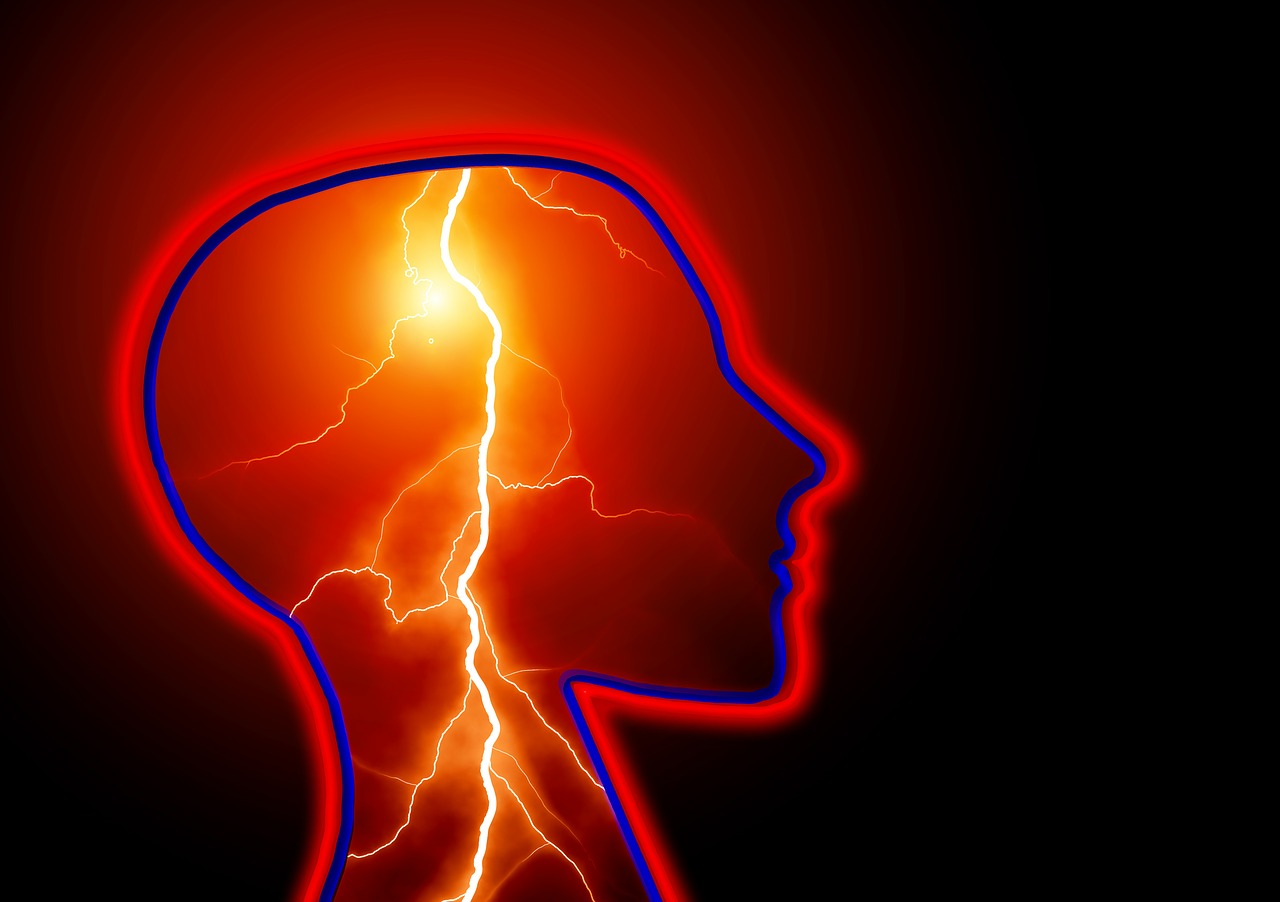 Migraine headacheepilepsy brain image