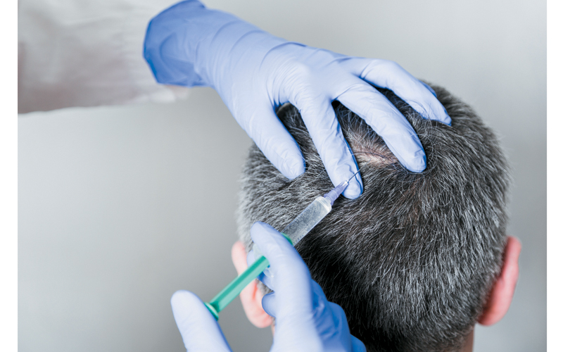 Botox Treatment