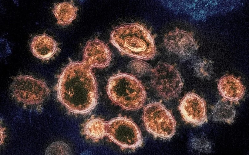coronavirus nih