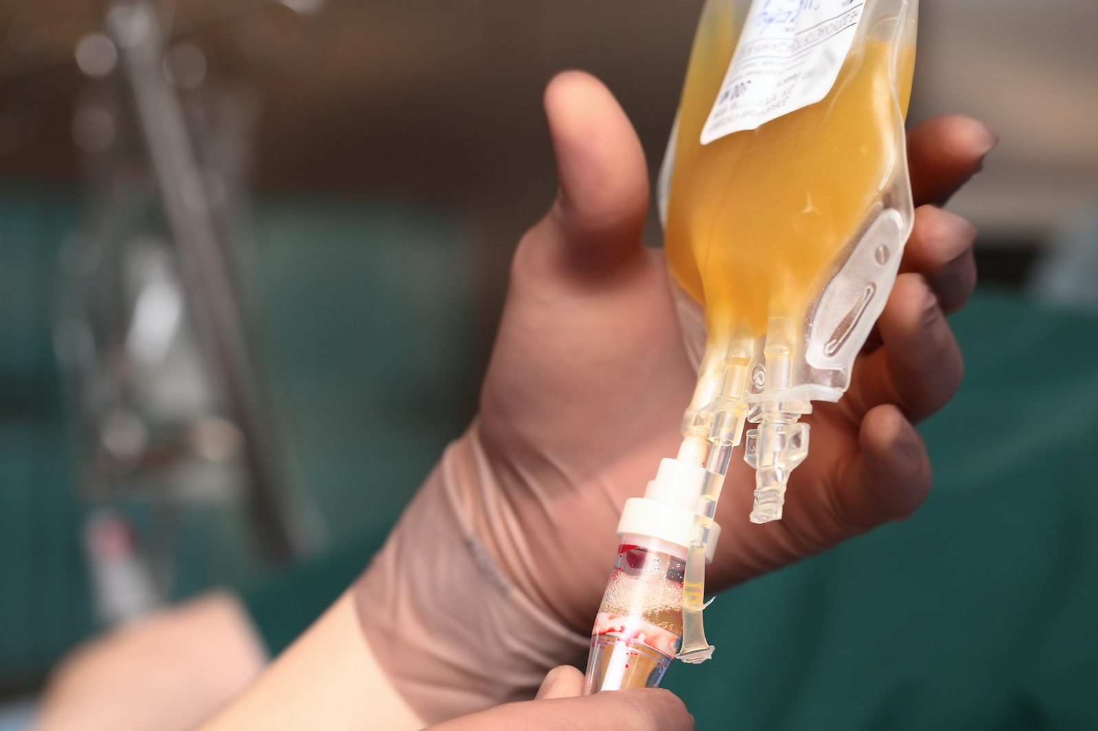 A picture of donated plasma