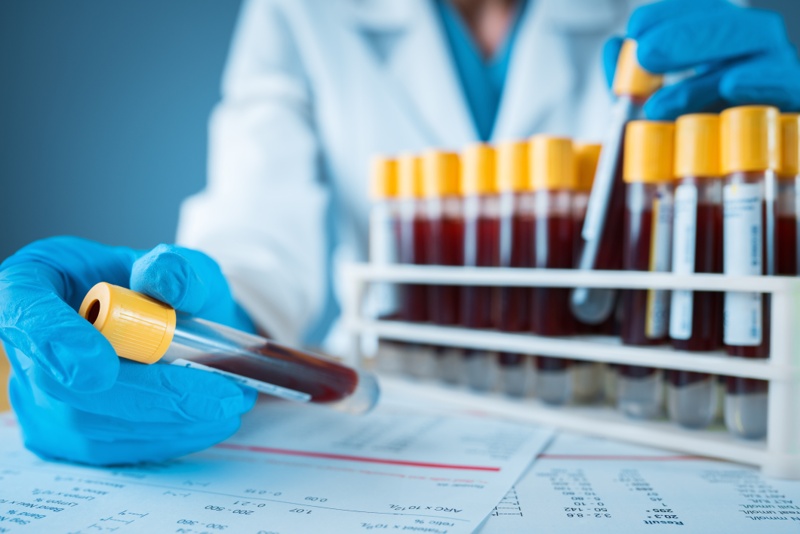 blood test