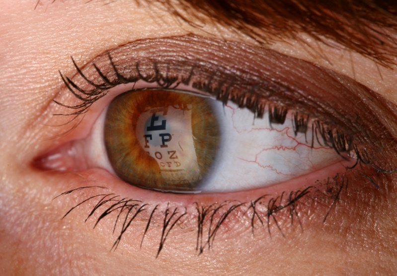 Eye Chart Eye Exam