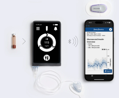 Beta Bionics iLet artificial pancreas